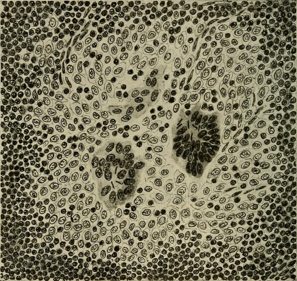 An illustration from Grundriss und Atlas der allgemeinen Chirurgie, 1905, leaf 330