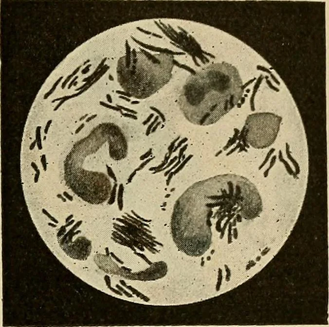 An illustration from Grundriss und Atlas der allgemeinen Chirurgie, 1905, leaf 359