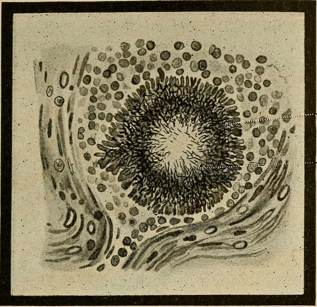 An illustration from Grundriss und Atlas der allgemeinen Chirurgie, 1905, leaf 363