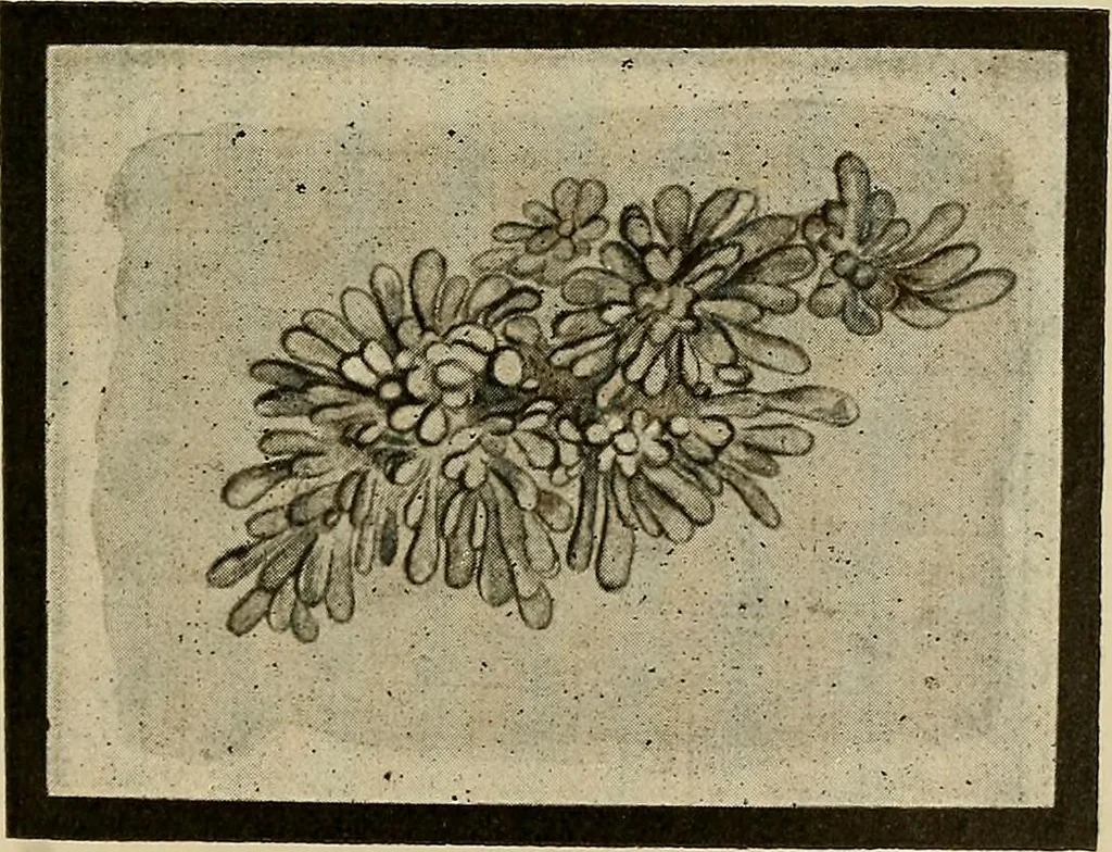 An illustration from Grundriss und Atlas der allgemeinen Chirurgie, 1905, leaf 363