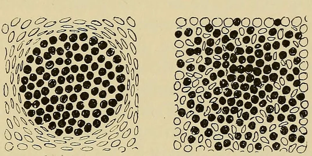 An illustration from Grundriss und Atlas der allgemeinen Chirurgie, 1905, leaf 379