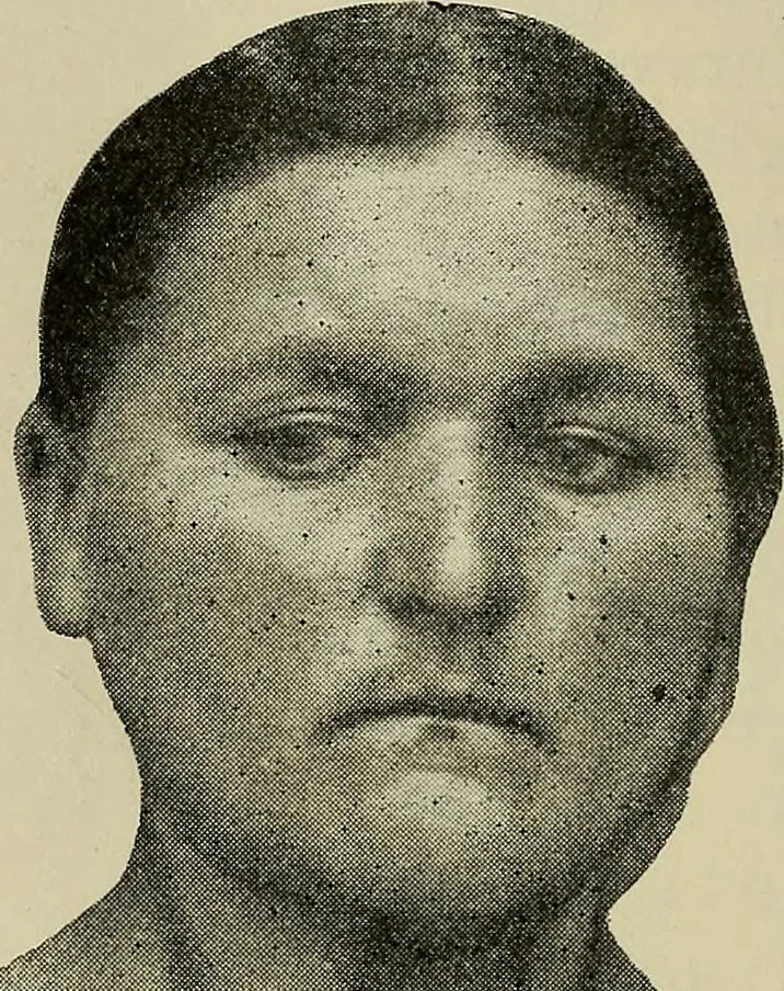 An illustration from Grundriss und Atlas der allgemeinen Chirurgie, 1905, leaf 386