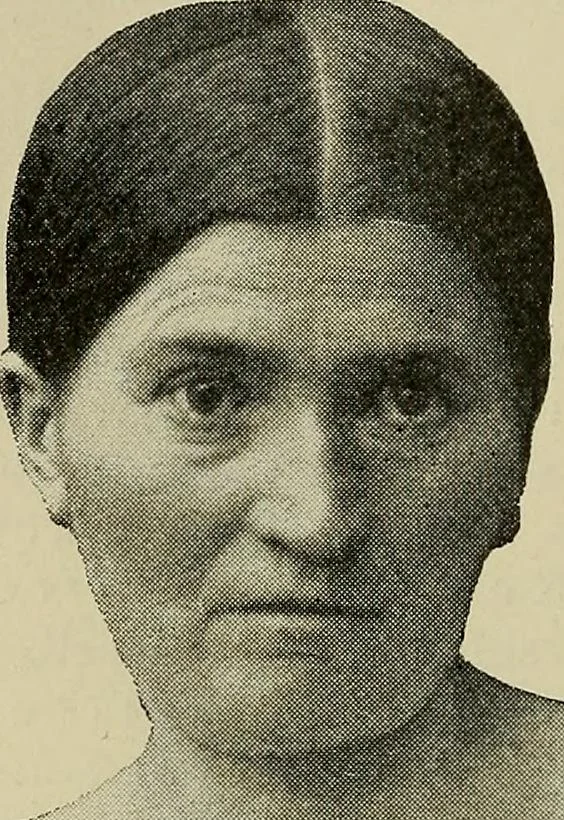 An illustration from Grundriss und Atlas der allgemeinen Chirurgie, 1905, leaf 392