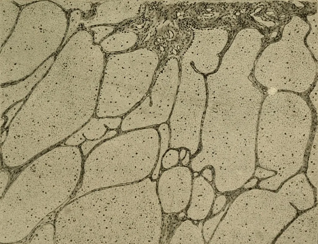 An illustration from Grundriss und Atlas der allgemeinen Chirurgie, 1905, leaf 401