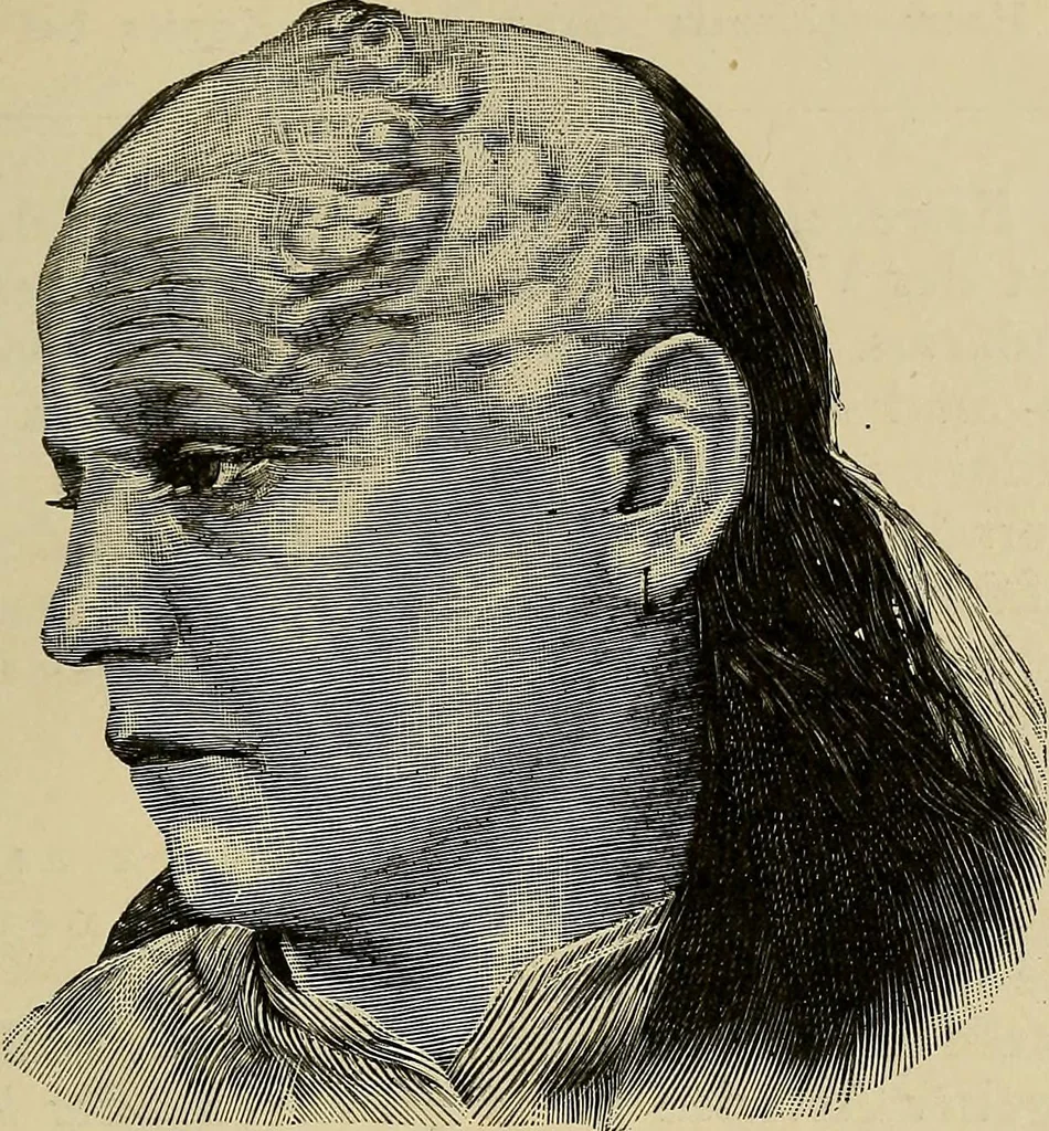 An illustration from Grundriss und Atlas der allgemeinen Chirurgie, 1905, leaf 405
