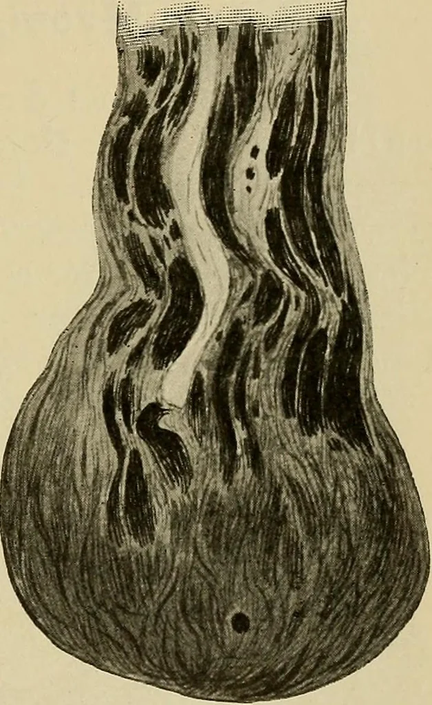 An illustration from Grundriss und Atlas der allgemeinen Chirurgie, 1905, leaf 411
