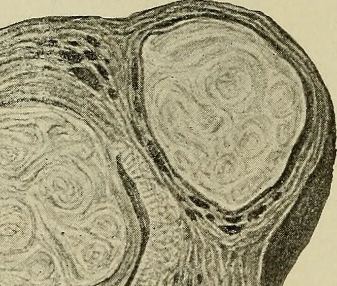 An illustration from Grundriss und Atlas der allgemeinen Chirurgie, 1905, leaf 412