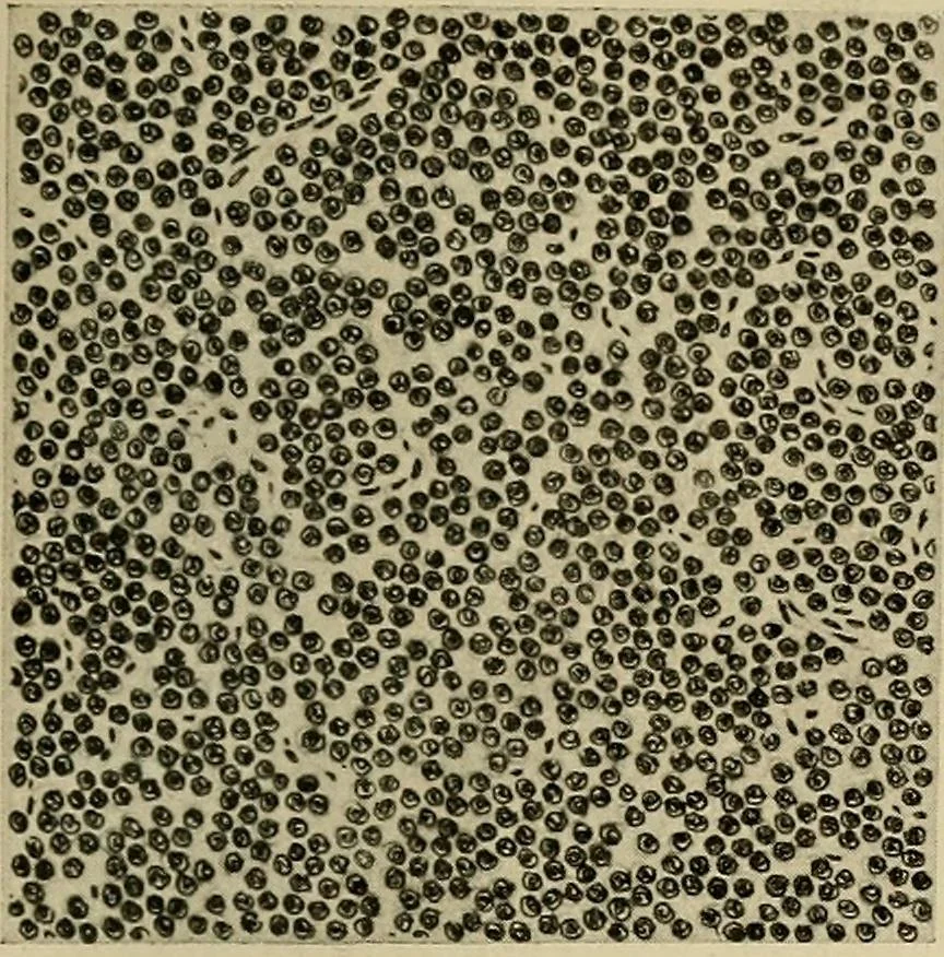 An illustration from Grundriss und Atlas der allgemeinen Chirurgie, 1905, leaf 419