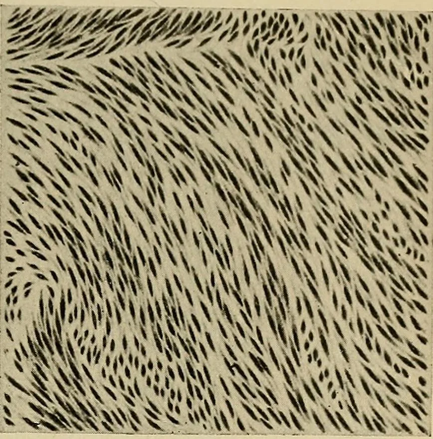 An illustration from Grundriss und Atlas der allgemeinen Chirurgie, 1905, leaf 419