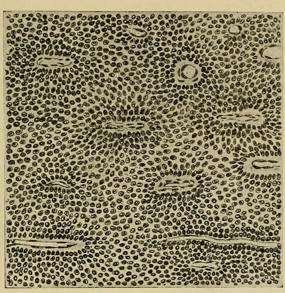An illustration from Grundriss und Atlas der allgemeinen Chirurgie, 1905, leaf 421