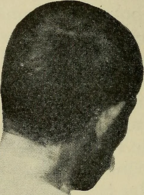An illustration from Grundriss und Atlas der allgemeinen Chirurgie, 1905, leaf 424