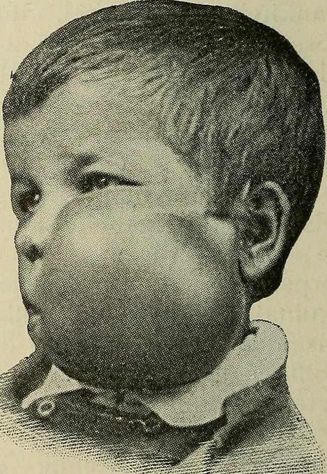An illustration from Grundriss und Atlas der allgemeinen Chirurgie, 1905, leaf 426
