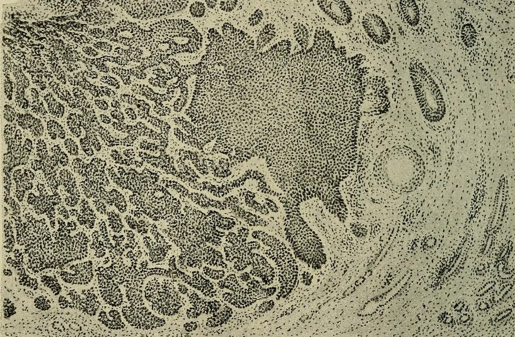 An illustration from Grundriss und Atlas der allgemeinen Chirurgie, 1905, leaf 436