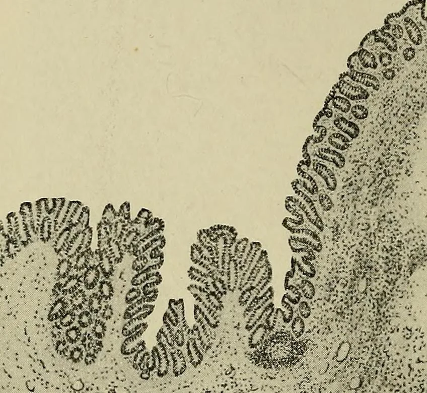 An illustration from Grundriss und Atlas der allgemeinen Chirurgie, 1905, leaf 438