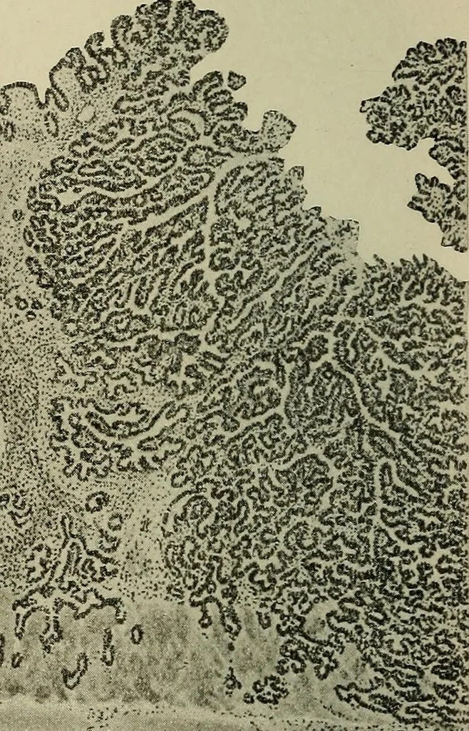 An illustration from Grundriss und Atlas der allgemeinen Chirurgie, 1905, leaf 438