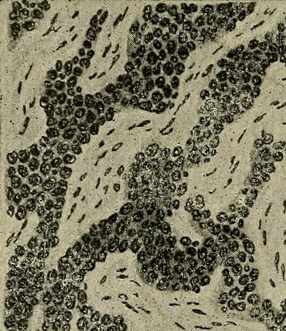 An illustration from Grundriss und Atlas der allgemeinen Chirurgie, 1905, leaf 440