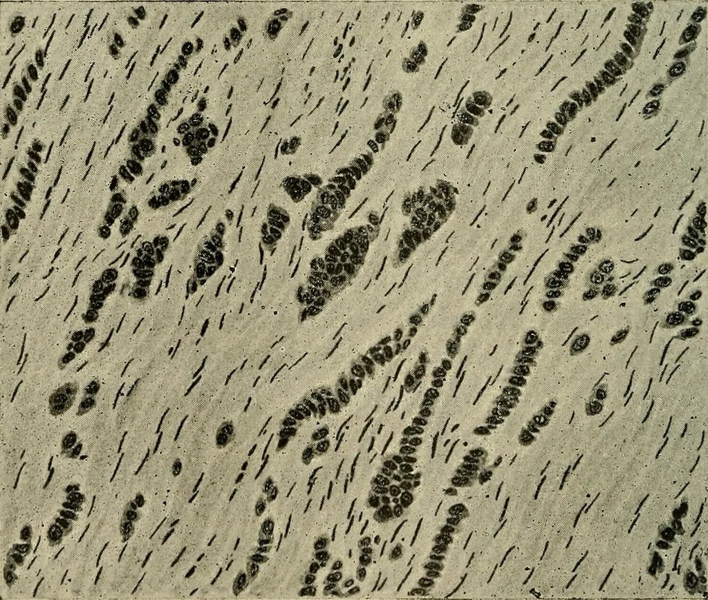 An illustration from Grundriss und Atlas der allgemeinen Chirurgie, 1905, leaf 440