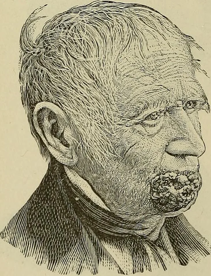 An illustration from Grundriss und Atlas der allgemeinen Chirurgie, 1905, leaf 446