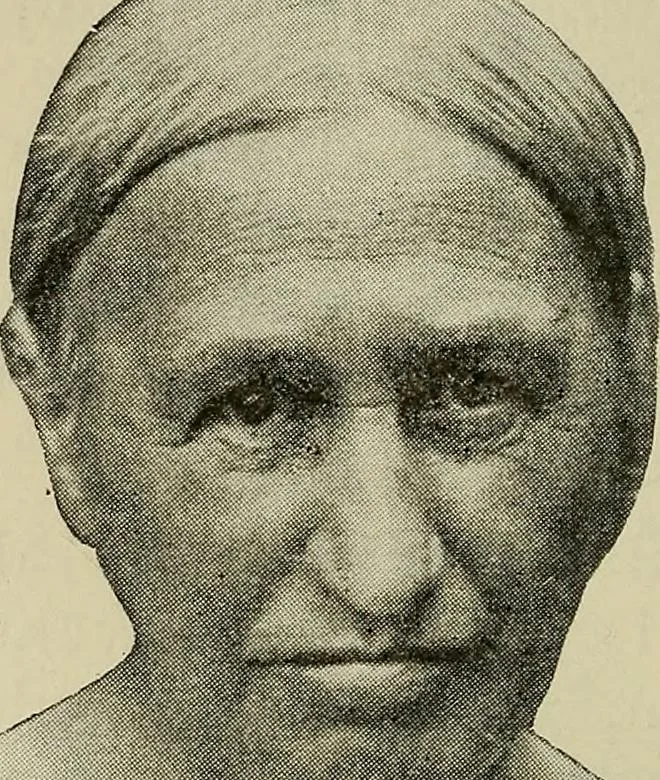 An illustration from Grundriss und Atlas der allgemeinen Chirurgie, 1905, leaf 448