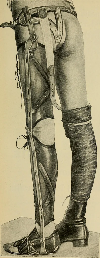 An illustration from Grundriss und Atlas der allgemeinen Chirurgie, 1905, leaf 499
