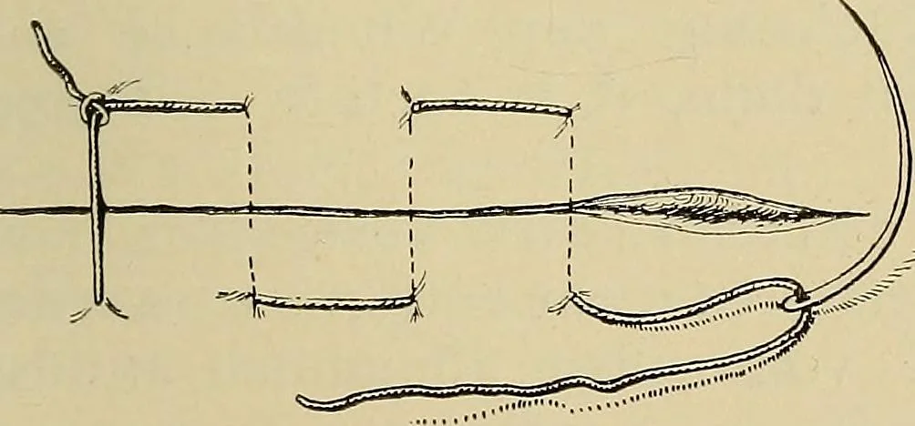 An illustration from Grundriss und Atlas der allgemeinen Chirurgie, 1905, leaf 77