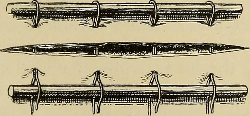 An illustration from Grundriss und Atlas der allgemeinen Chirurgie, 1905, leaf 77