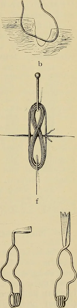 An illustration from Grundriss und Atlas der allgemeinen Chirurgie, 1905, leaf 77
