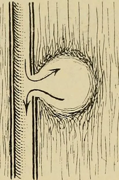 An illustration from Grundriss und Atlas der allgemeinen Chirurgie, 1905, leaf 97