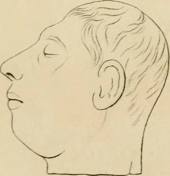 An illustration from Grundzüge der Phrenologie; oder, Anleitung zum Studium dieser Wissenschaft, 1842, leaf 390