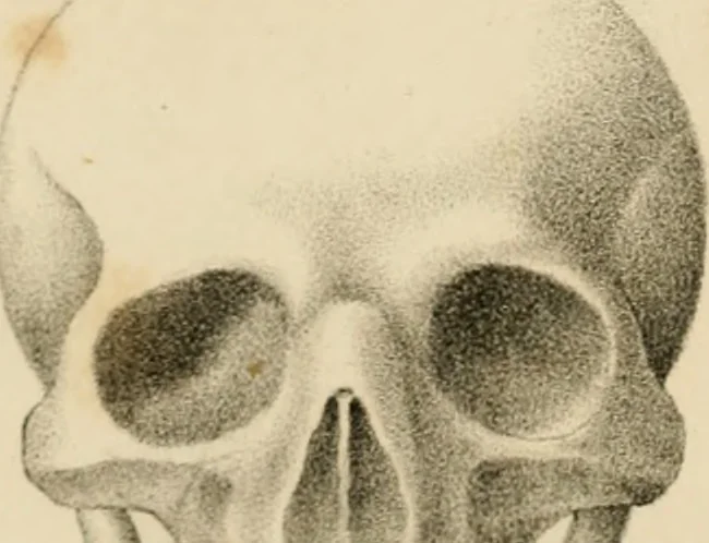 An illustration from Grundzüge der Phrenologie; oder, Anleitung zum Studium dieser Wissenschaft, 1842, leaf 396