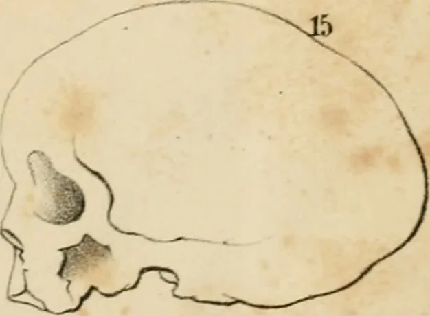 An illustration from Grundzüge der Phrenologie; oder, Anleitung zum Studium dieser Wissenschaft, 1842, leaf 398