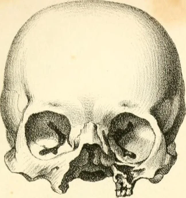 An illustration from Grundzüge der Phrenologie; oder, Anleitung zum Studium dieser Wissenschaft, mit Berücksichtigung der neueren Forschungen auf dem Gebiete der Physiologie und Psychologie, 1856, leaf 622