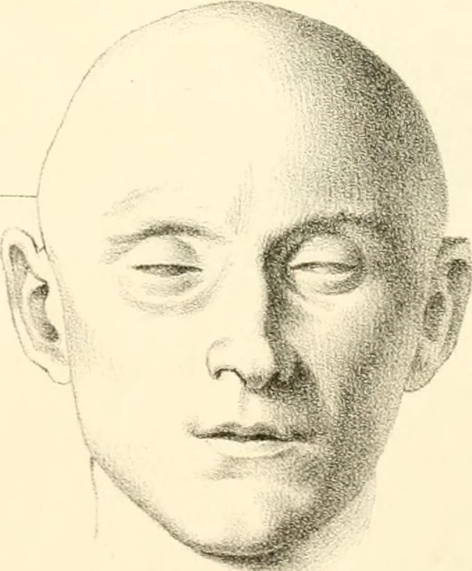 An illustration from Grundzüge der Phrenologie; oder, Anleitung zum Studium dieser Wissenschaft, mit Berücksichtigung der neueren Forschungen auf dem Gebiete der Physiologie und Psychologie, 1856, leaf 624