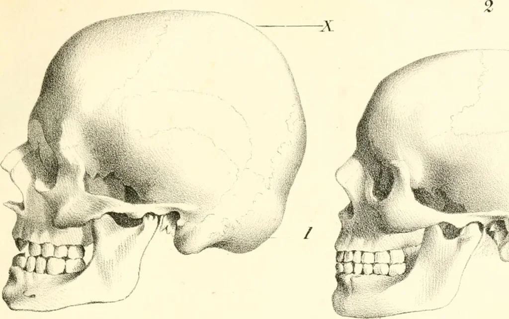 An illustration from Grundzüge der Phrenologie; oder, Anleitung zum Studium dieser Wissenschaft, mit Berücksichtigung der neueren Forschungen auf dem Gebiete der Physiologie und Psychologie, 1856, leaf 626