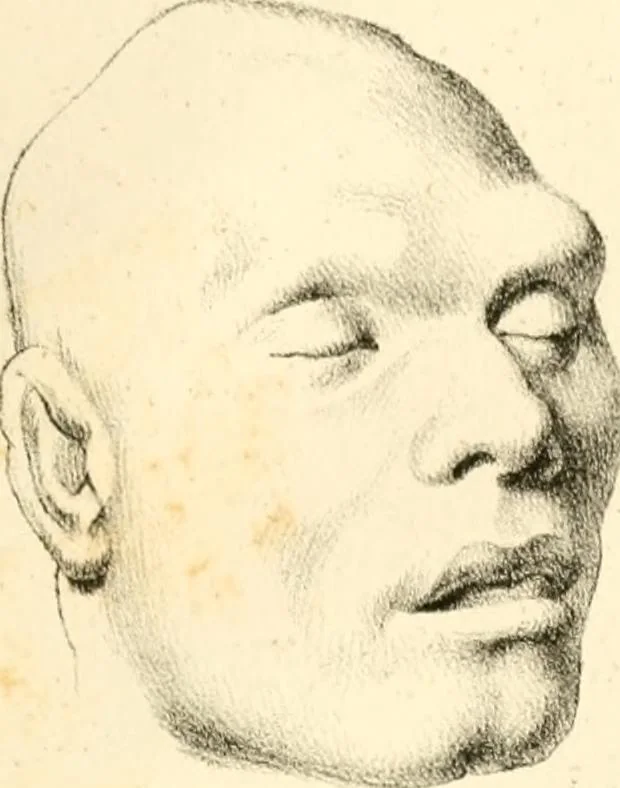 An illustration from Grundzüge der Phrenologie; oder, Anleitung zum Studium dieser Wissenschaft, mit Berücksichtigung der neueren Forschungen auf dem Gebiete der Physiologie und Psychologie, 1856, leaf 632