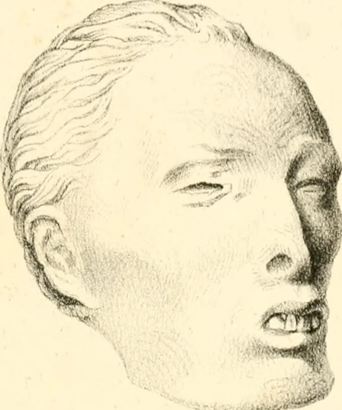 An illustration from Grundzüge der Phrenologie; oder, Anleitung zum Studium dieser Wissenschaft, mit Berücksichtigung der neueren Forschungen auf dem Gebiete der Physiologie und Psychologie, 1856, leaf 632