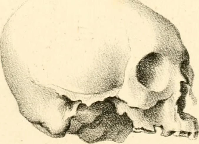 An illustration from Grundzüge der Phrenologie; oder, Anleitung zum Studium dieser Wissenschaft, mit Berücksichtigung der neueren Forschungen auf dem Gebiete der Physiologie und Psychologie, 1856, leaf 632