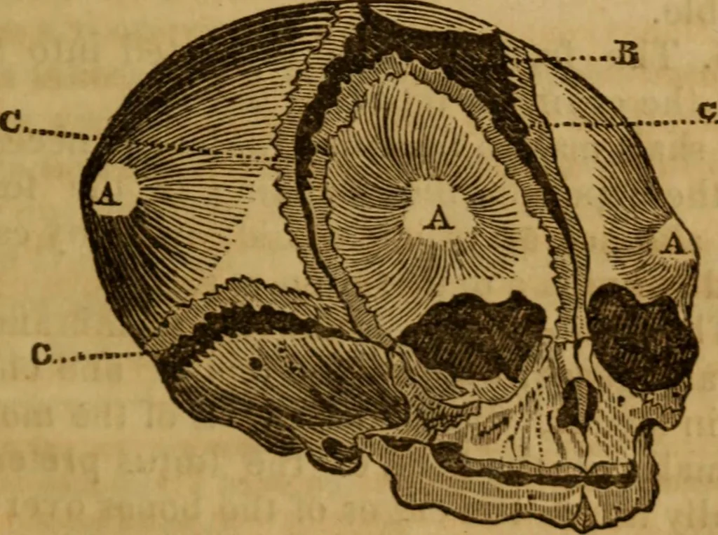 An illustration from A guide to human and comparative phrenology : With observations on the national varieties of the cranium, and a description of Drs. Gall and Spurzheim's method of dissecting the human brain, 1831, leaf 61