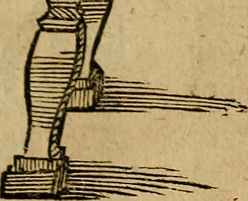 An illustration from Guilhelmi FabricI Hildani inclytae reipublicae Bernensis Helvet. medico-chirurgi ordinarii De gangraena et sphacelo, tractatus methodicus : in quo horum morborum differentiae, causae, signa, prognostica, ac denique methodica curatio continentur, 1617, leaf 164