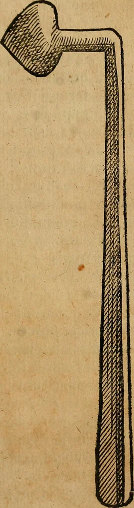 An illustration from Guilhelmi FabricI Hildani inclytae reipublicae Bernensis Helvet. medico-chirurgi ordinarii De gangraena et sphacelo, tractatus methodicus : in quo horum morborum differentiae, causae, signa, prognostica, ac denique methodica curatio continentur, 1617, leaf 176