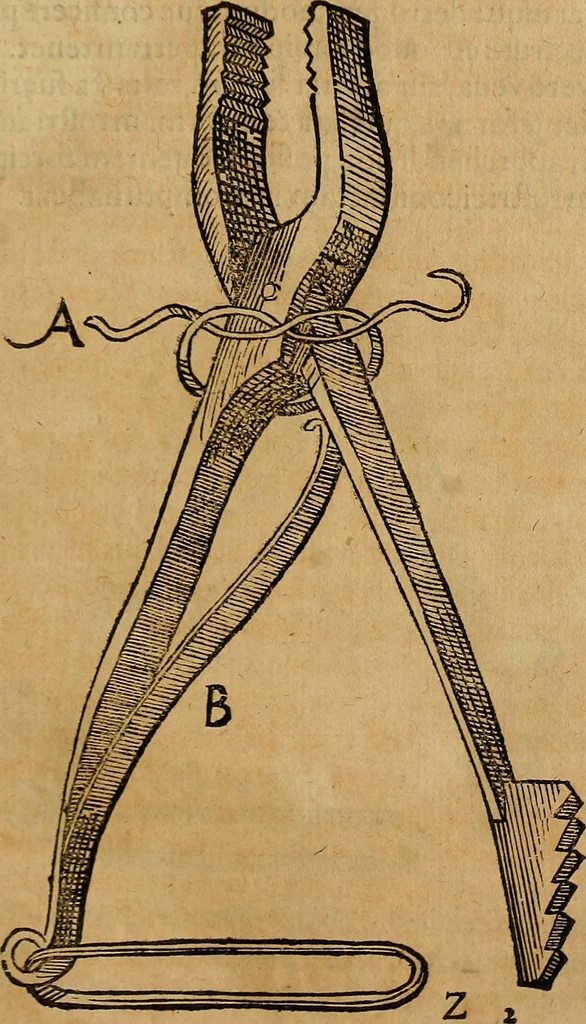 An illustration from Guilhelmi FabricI Hildani inclytae reipublicae Bernensis Helvet. medico-chirurgi ordinarii De gangraena et sphacelo, tractatus methodicus : in quo horum morborum differentiae, causae, signa, prognostica, ac denique methodica curatio continentur, 1617, leaf 186