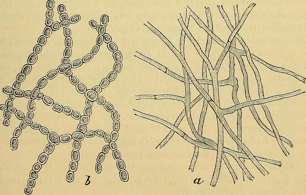 An illustration from Handbuch der klinischen Mikroskopie : mit Berücksichtigung der wichtigsten chemischen Untersuchungen am Krankenbette und der Verwendung des Mikroskopes in der gerichtlichen Medicin, 1883, leaf 104