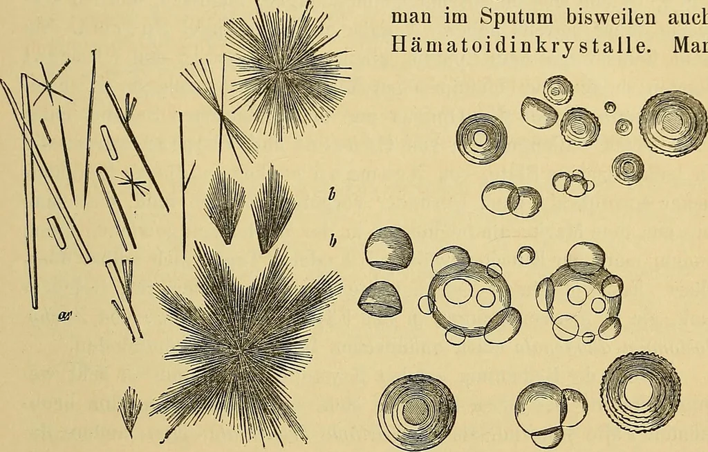 An illustration from Handbuch der klinischen Mikroskopie : mit Berücksichtigung der wichtigsten chemischen Untersuchungen am Krankenbette und der Verwendung des Mikroskopes in der gerichtlichen Medicin, 1883, leaf 166