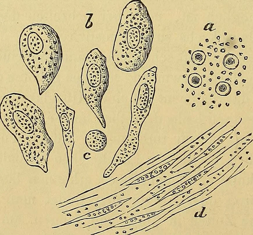 An illustration from Handbuch der klinischen Mikroskopie : mit Berücksichtigung der wichtigsten chemischen Untersuchungen am Krankenbette und der Verwendung des Mikroskopes in der gerichtlichen Medicin, 1883, leaf 233