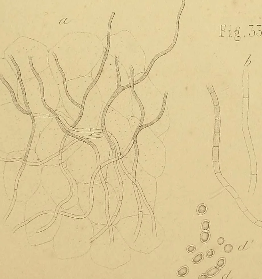 An illustration from Handbuch der klinischen Mikroskopie : mit Berücksichtigung der wichtigsten chemischen Untersuchungen am Krankenbette und der Verwendung des Mikroskopes in der gerichtlichen Medicin, 1883, leaf 280
