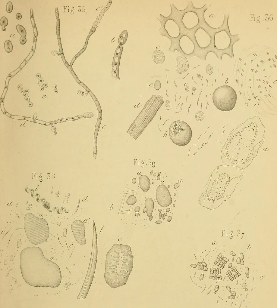 An illustration from Handbuch der klinischen Mikroskopie : mit Berücksichtigung der wichtigsten chemischen Untersuchungen am Krankenbette und der Verwendung des Mikroskopes in der gerichtlichen Medicin, 1883, leaf 284