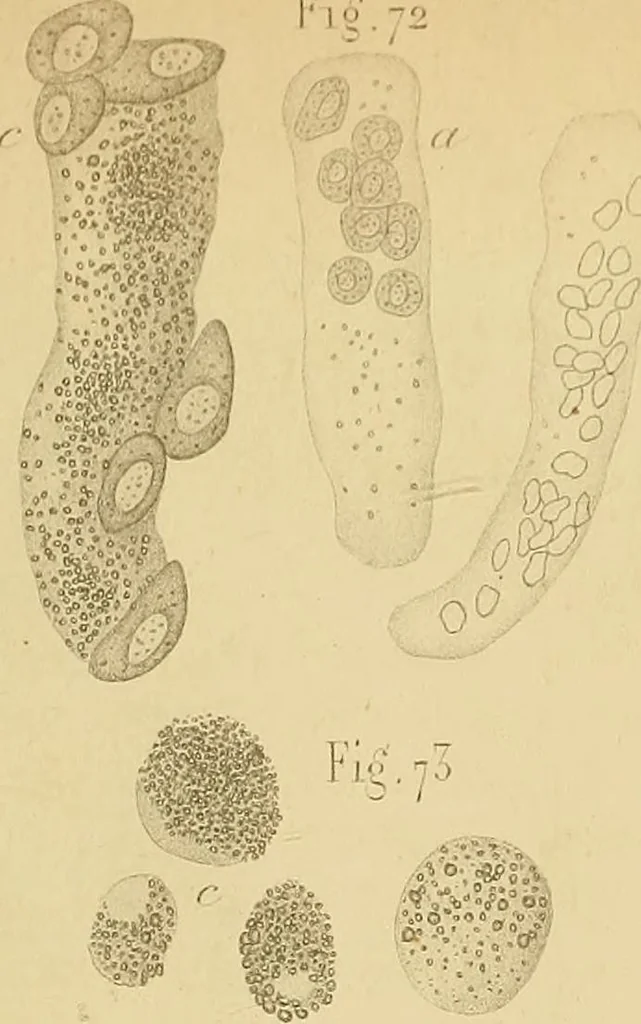 An illustration from Handbuch der klinischen Mikroskopie : mit Berücksichtigung der wichtigsten chemischen Untersuchungen am Krankenbette und der Verwendung des Mikroskopes in der gerichtlichen Medicin, 1883, leaf 296