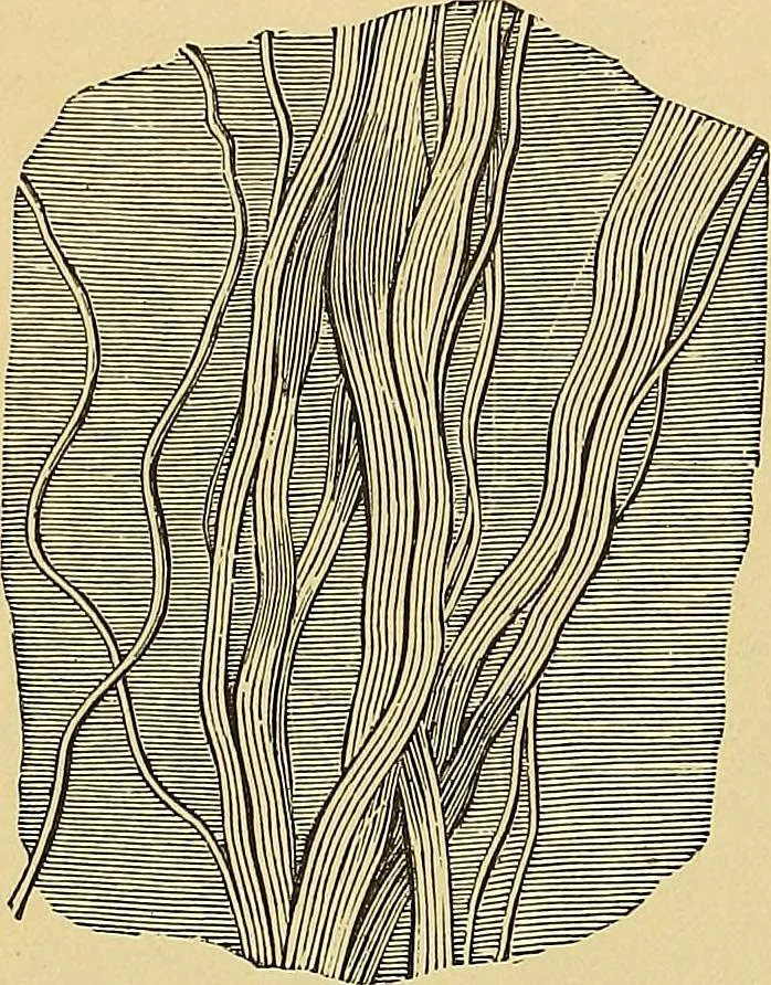 An illustration from Handbuch der klinischen Mikroskopie : mit Berücksichtigung der wichtigsten chemischen Untersuchungen am Krankenbette und der Verwendung des Mikroskopes in der gerichtlichen Medicin, 1883, leaf 89