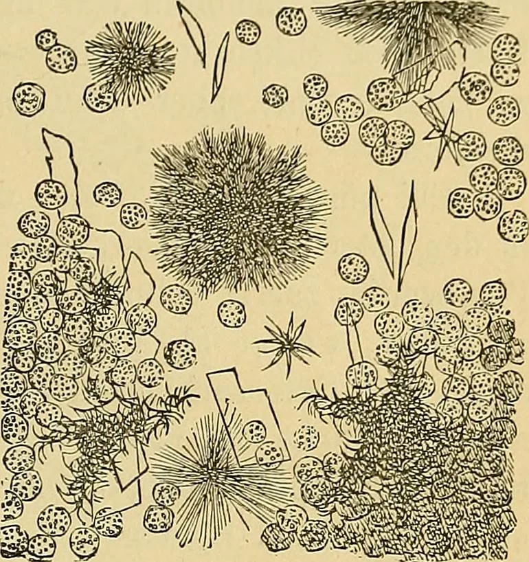 An illustration from Handbuch der klinischen Mikroskopie : mit Berücksichtigung der wichtigsten chemischen Untersuchungen am Krankenbette und der Verwendung des Mikroskopes in der gerichtlichen Medicin, 1883, leaf 90