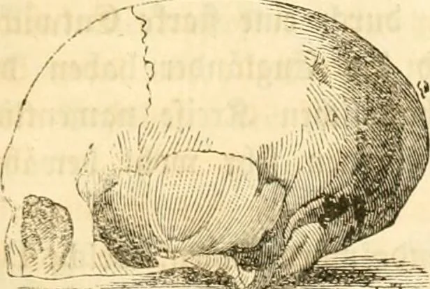An illustration from Handbuch der Phrenologie, 1845, leaf 101